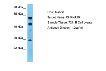 CHRNA10 Rabbit Polyclonal Antibody
