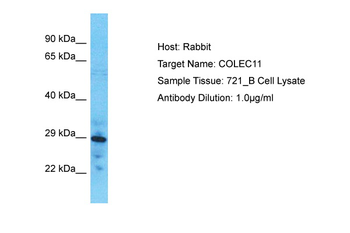 COLEC11 Rabbit Polyclonal Antibody
