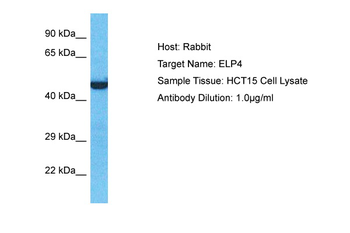 ELP4 Rabbit Polyclonal Antibody