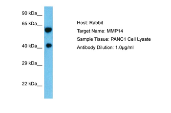 MMP14 Rabbit Polyclonal Antibody