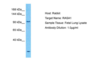 RASA1 Rabbit Polyclonal Antibody