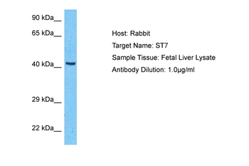 ST7 Rabbit Polyclonal Antibody
