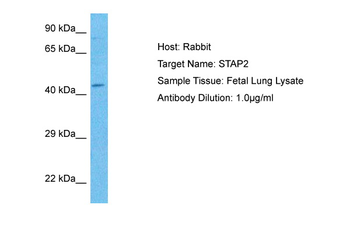 STAP2 Rabbit Polyclonal Antibody