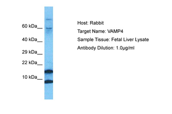 VAMP4 Rabbit Polyclonal Antibody