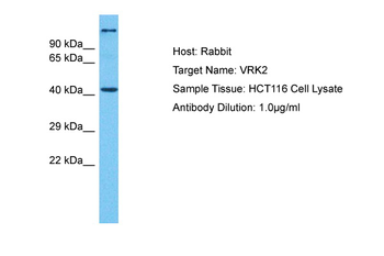 VRK2 Rabbit Polyclonal Antibody