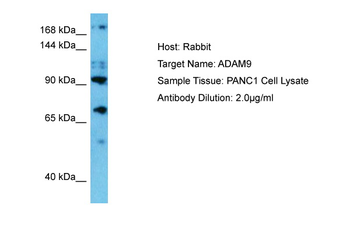 ADAM9 Rabbit Polyclonal Antibody