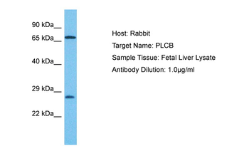 AGPAT2 Rabbit Polyclonal Antibody
