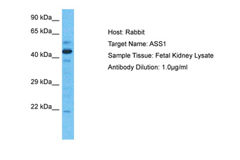 ASS1 Rabbit Polyclonal Antibody