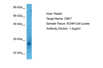 CBX7 Rabbit Polyclonal Antibody
