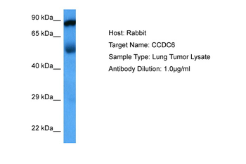CCDC6 Rabbit Polyclonal Antibody