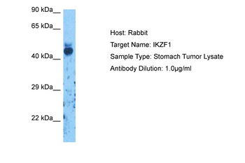 IKZF1 Rabbit Polyclonal Antibody