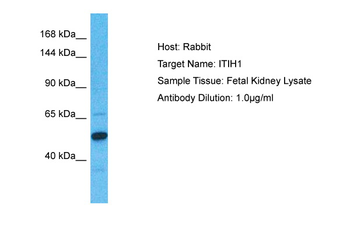 ITIH1 Rabbit Polyclonal Antibody