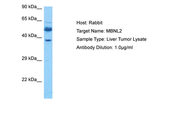 MBNL2 Rabbit Polyclonal Antibody