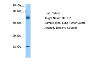OTUB2 Rabbit Polyclonal Antibody