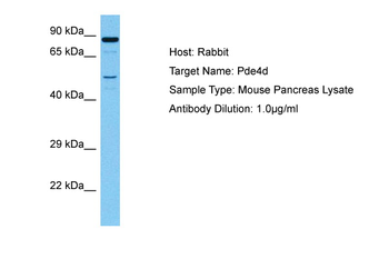 PDE4D Rabbit Polyclonal Antibody