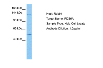 PDS5A Rabbit Polyclonal Antibody