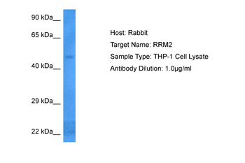 RRM2 Rabbit Polyclonal Antibody