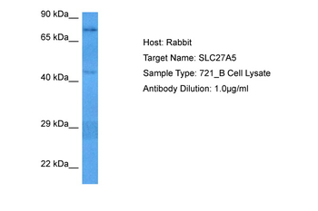SLC27A5 Rabbit Polyclonal Antibody