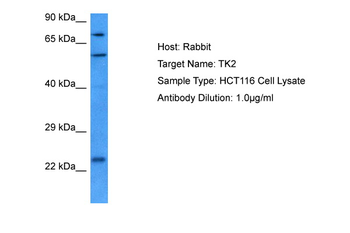 TK2 Rabbit Polyclonal Antibody