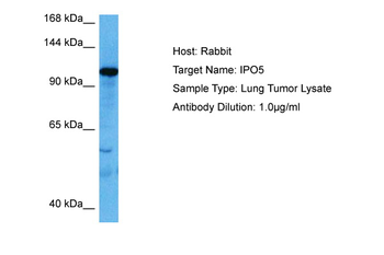 IPO5 Rabbit Polyclonal Antibody