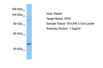 IPO5 Rabbit Polyclonal Antibody