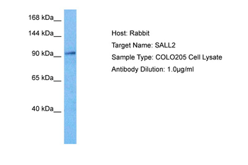 SALL2 Rabbit Polyclonal Antibody