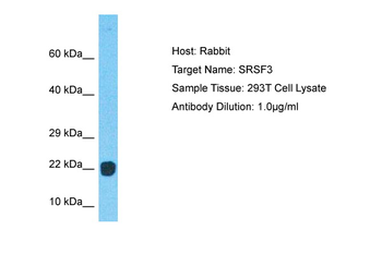 SRSF3 Rabbit Polyclonal Antibody