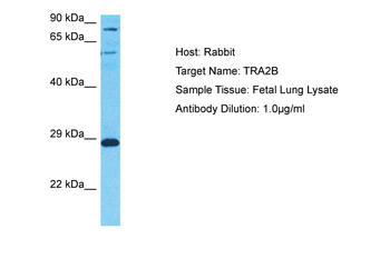 TRA2B Rabbit Polyclonal Antibody
