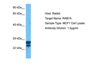 RAB7A Rabbit Polyclonal Antibody