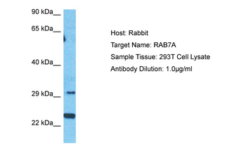 RAB7A Rabbit Polyclonal Antibody