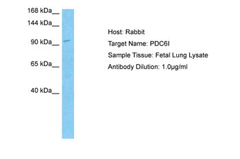 PDCD6IP Rabbit Polyclonal Antibody