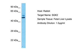 SGK2 Rabbit Polyclonal Antibody