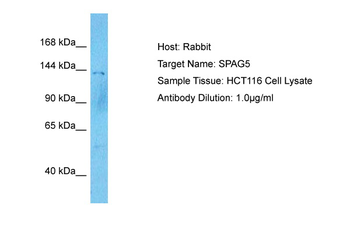 SPAG5 Rabbit Polyclonal Antibody