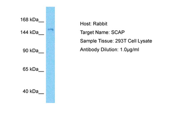 SCAP Rabbit Polyclonal Antibody
