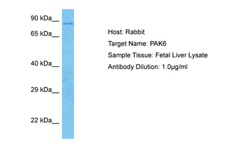 PAK6 Rabbit Polyclonal Antibody