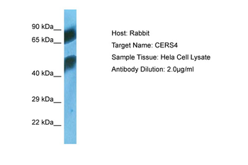 CERS4 Rabbit Polyclonal Antibody