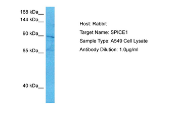 SPICE1 Rabbit Polyclonal Antibody