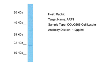 ARF1 Rabbit Polyclonal Antibody