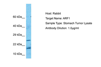 ARF1 Rabbit Polyclonal Antibody