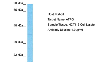 ATP5F1C Rabbit Polyclonal Antibody