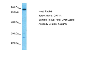 CPT1A Rabbit Polyclonal Antibody
