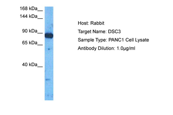 DSC3 Rabbit Polyclonal Antibody