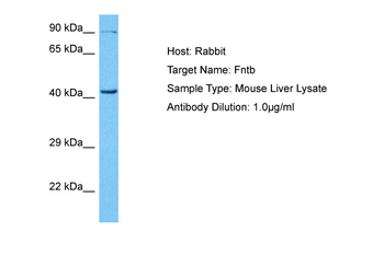 FNTB Rabbit Polyclonal Antibody