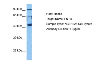 FNTB Rabbit Polyclonal Antibody