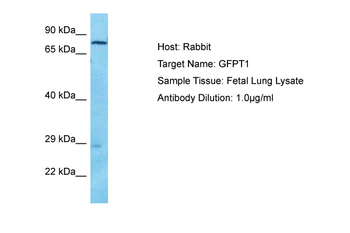 GFPT1 Rabbit Polyclonal Antibody
