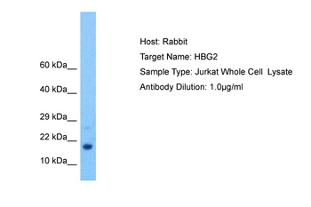 HBG2 Rabbit Polyclonal Antibody