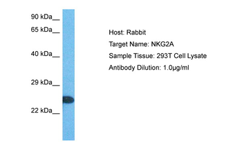 KLRC1 Rabbit Polyclonal Antibody