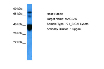 MAGEA6 Rabbit Polyclonal Antibody