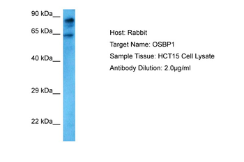 OSBP Rabbit Polyclonal Antibody