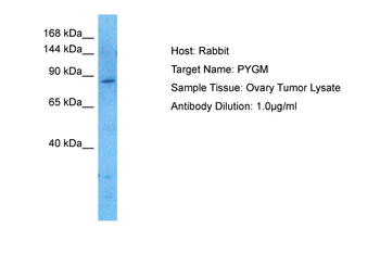 PYGM Rabbit Polyclonal Antibody
